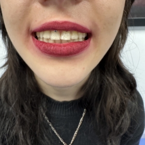piercing