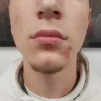 Pret Piercing Buza Pret Piercing Buza