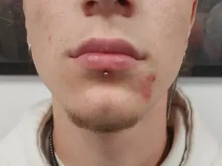 Pret Piercing Buza Pret Piercing Buza
