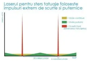 puls stergere tatuaj