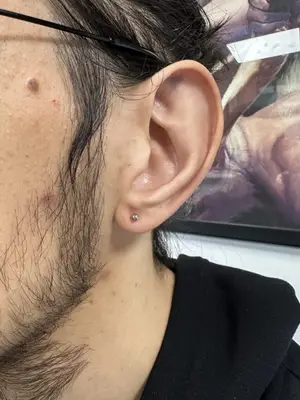 Piercing Lob