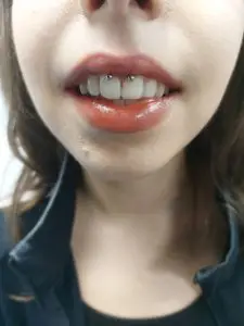Pret Piercing Smiley