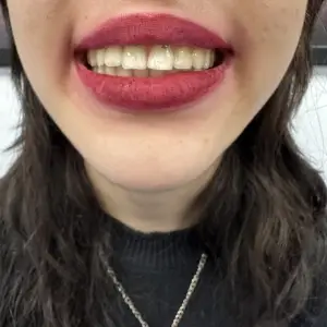 Piercing Smiley