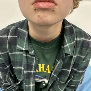 Piercing Snake Bites